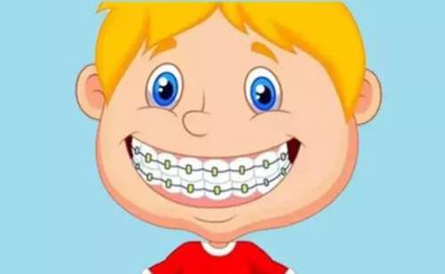 成人牙齿正畸费用是多少？受哪些因素引起