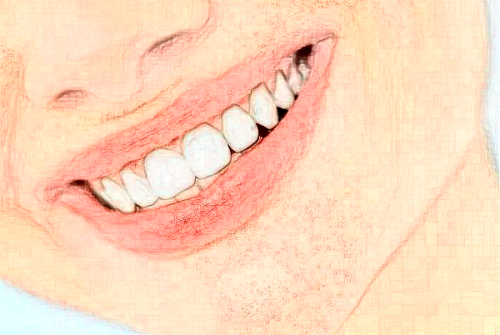 地包天牙齿矫正方法