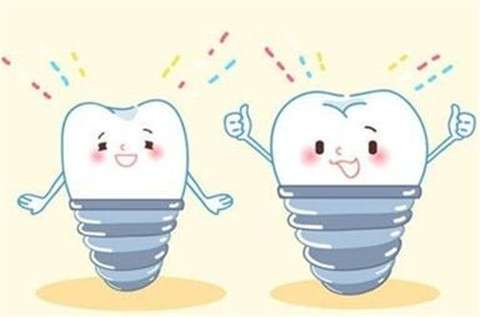 韩国登腾种植牙：使用寿命长达25年！